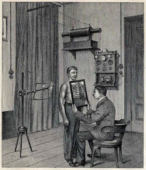 Prime Radiografie