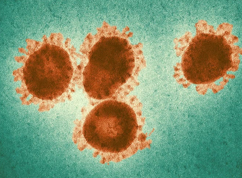 Virus Covid-19