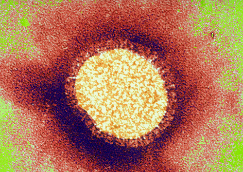 Virus Spagnola
